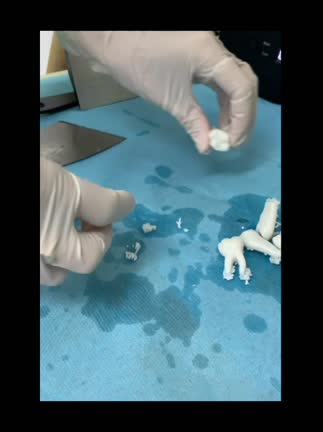 POSTPROCESADO DE LOS DIENTES IMPRESOS EN RESINA